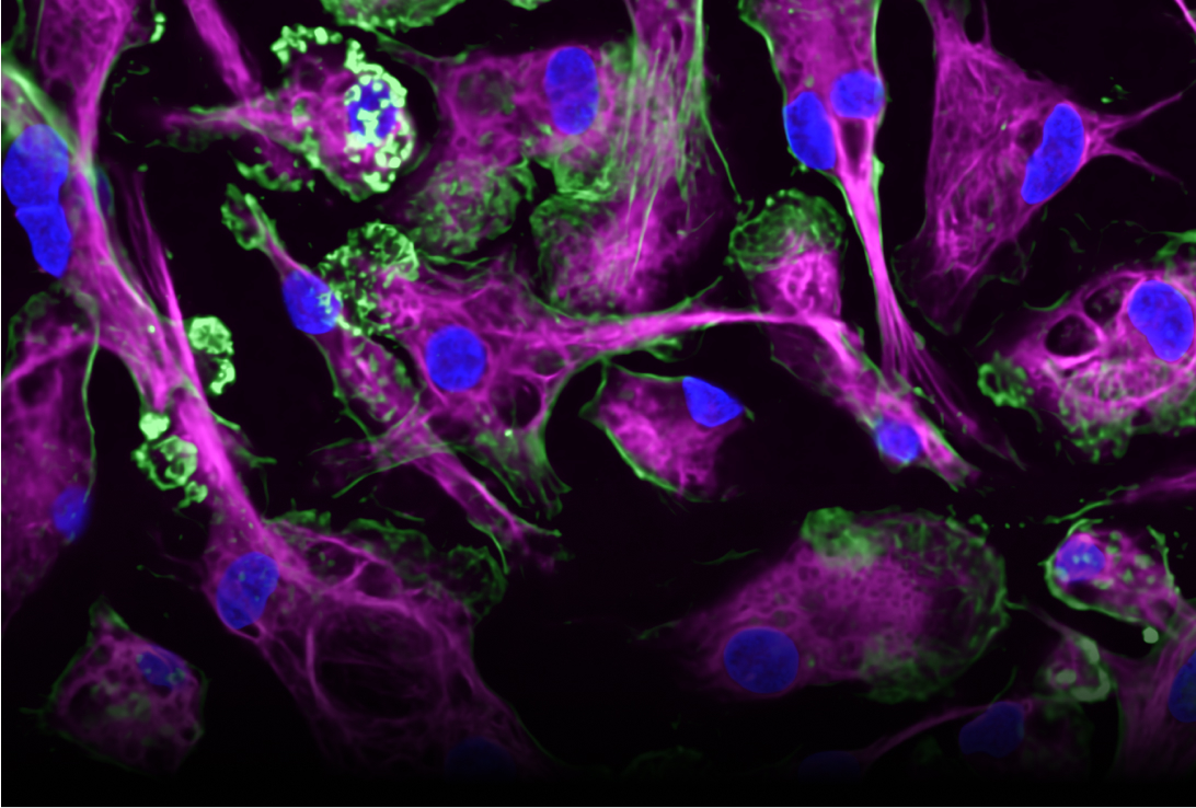 Human iPSC-derived macrophages. Markers are: DAPI (blue), actin (green), CD68 (magenta).