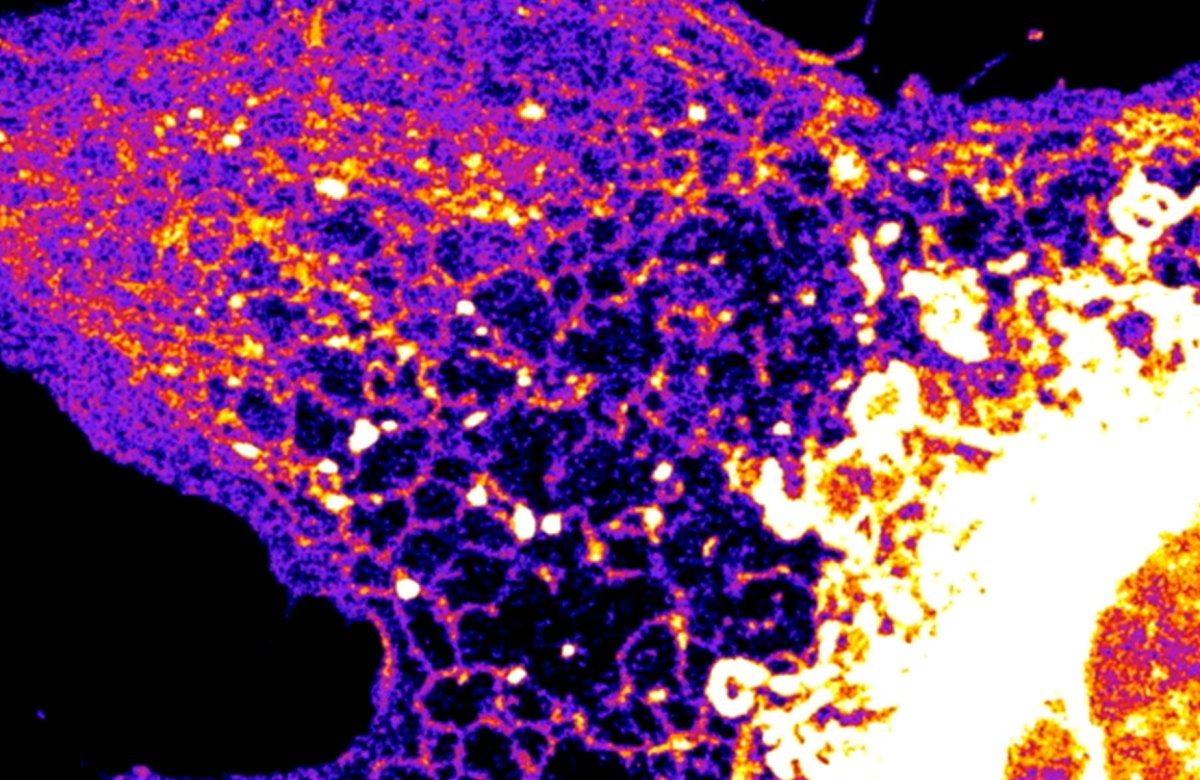A purple and pink fibroblast cell is displayed against a black background.