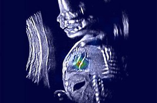 med-imaging-ultrasound