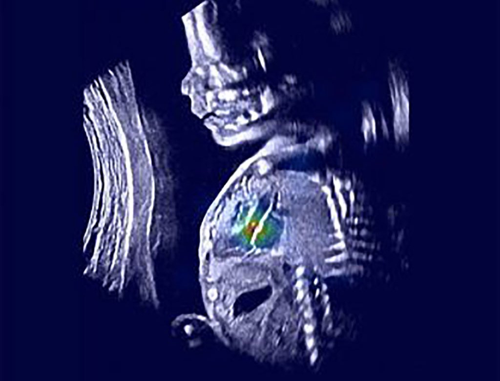 med-imaging-ultrasound