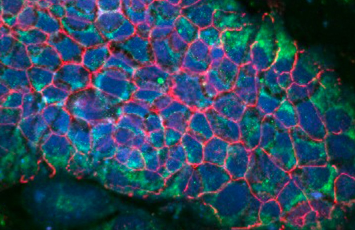 A cluster of fluorescent cells are illuminated with red, green and blue light.