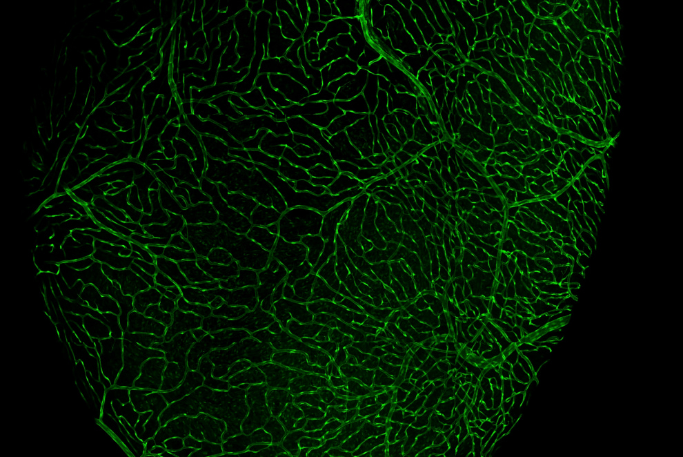 CZ Biohub Chicago - Zebrafish Coronary