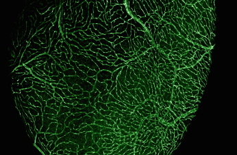 CZ Biohub Chicago - Zebrafish Coronary