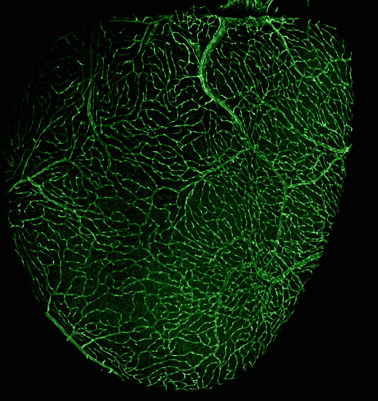 zebrafish heart coronary vessel