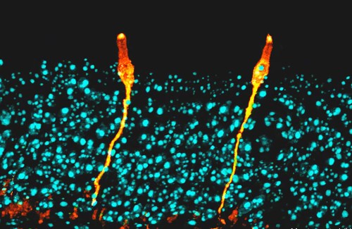 Pulmonary ionocytes (orange) extend through neighboring epithelial cells in the upper respiratory tract of the mouse, to the surface of the epithelial lining; cell nuclei in cyan.