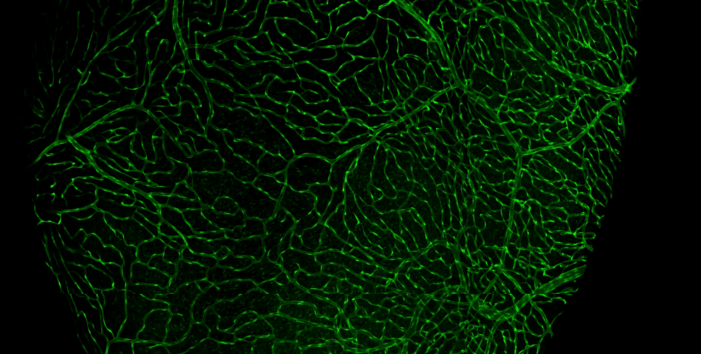 Zebrafish coranary