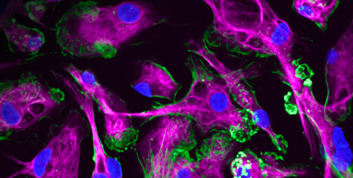Human iPSC-derived macrophages. Markers are: DAPI (blue), actin (green), CD68 (magenta).