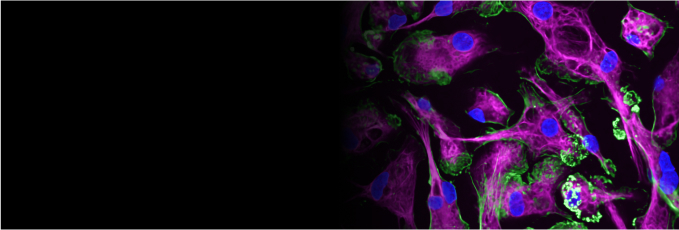 Human iPSC-derived macrophages. Markers are: DAPI (blue), actin (green), CD68 (magenta).