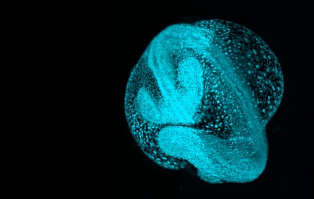 Zebrafish embryo