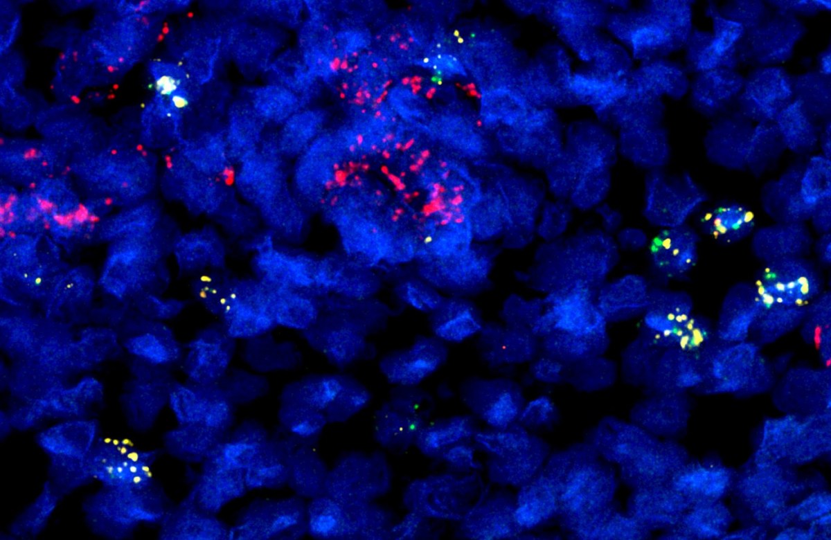 Small blue circles overlay a black background. Pink and yellow fluorescent spots appear around the image.