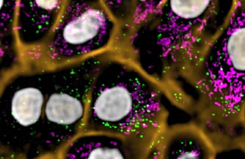 Fluorescent microscopy image showing cell structures with highlighted organelles in green, magenta, and orange