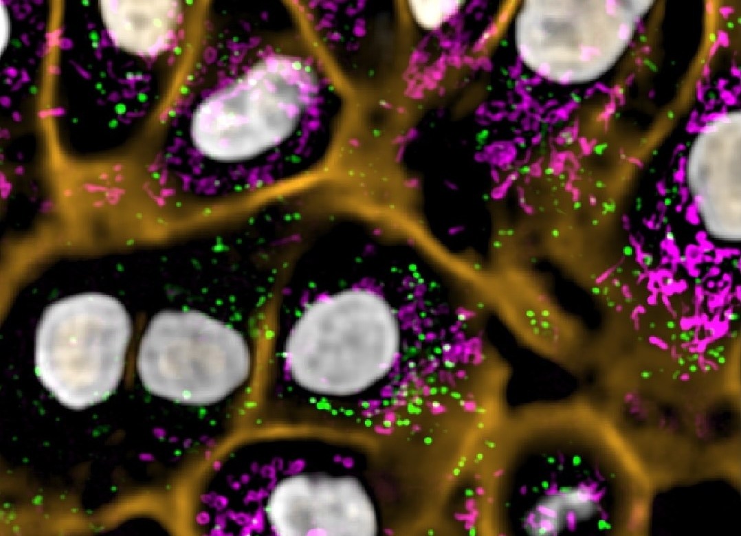 Fluorescent microscopy image showing cell structures with highlighted organelles in green, magenta, and orange
