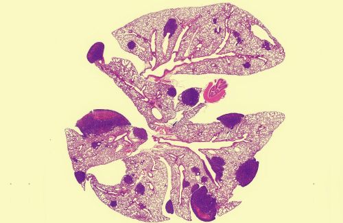 Mouse lung tissue showing PCSK9’s impact