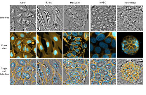 Label-free imaging combined with AI-powered virtual staining offers a game-changing alternative to conventional staining for many cell types