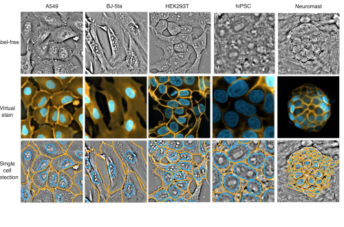 Label-free imaging combined with AI-powered virtual staining offers a game-changing alternative to conventional staining for many cell types