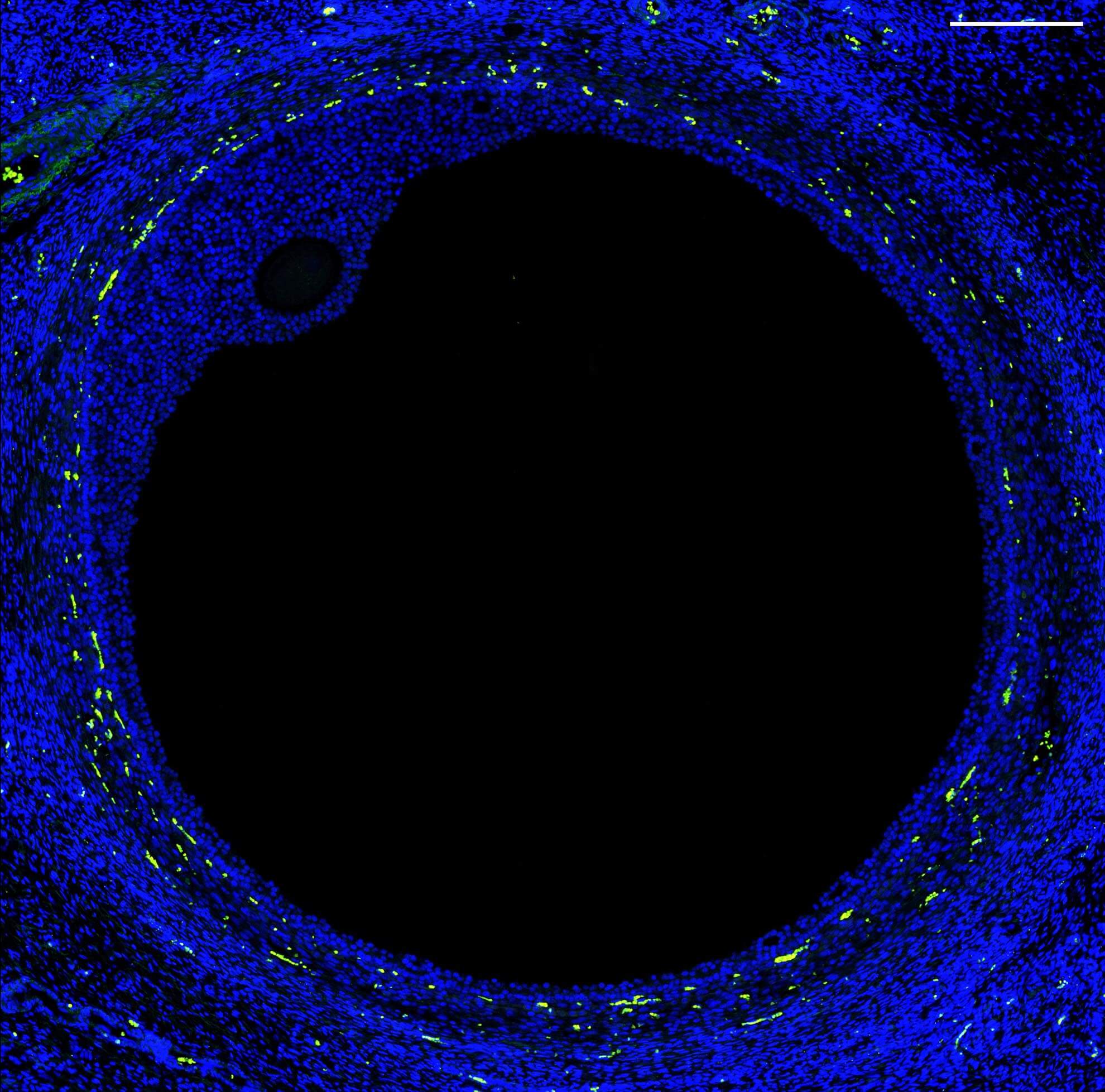 A black circle surrounded by many tiny bits of bright blue and seldom bright green and yellow.