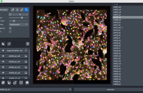 Visualization interface browses segmented cells infected with SARS-CoV-2 virus