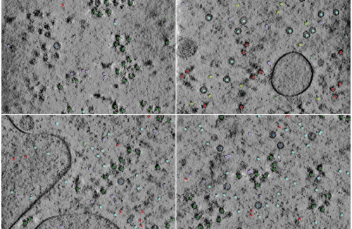 A set of sample tomograms including a selected set of the first-place team’s annotations.